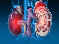 File photo of kidney