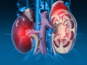 Kidneys 1
