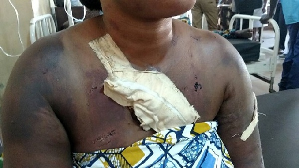 One of the alleged prostitutes attacked
