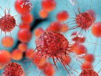 File photo of cancerous cell