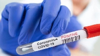 Ghana record fresh coronavirus cases after eased restrictions