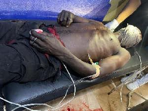 Police who visited the facility said the victims sustained suspected pellet wounds