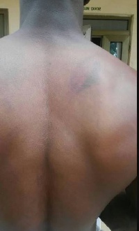 Police highway patrol team flogged Mohammed Osman in Damongo