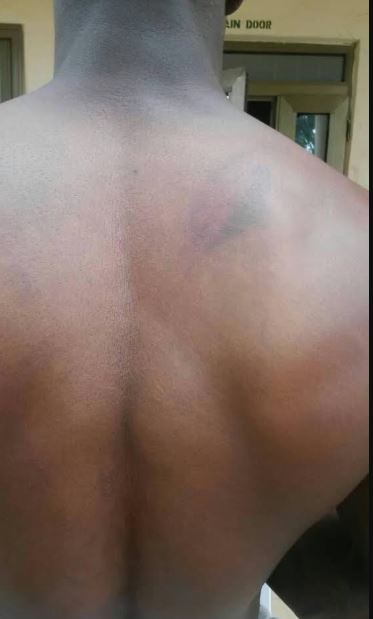 Police highway patrol team flogged Mohammed Osman in Damongo