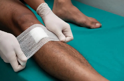 A file photo showing someone treating a serious wound