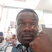 One of the assaulted Ghanaian Times journalists