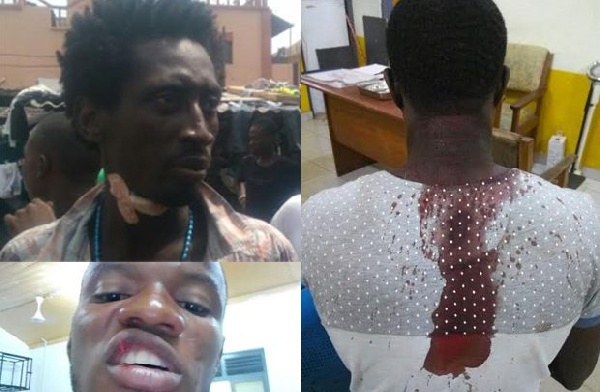 Some of the injured persons