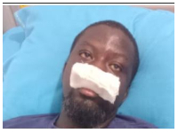Ibrahim Mahama after he was assaulted by the police in Tamale