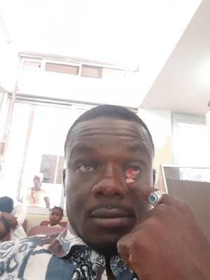 Malik Sullemana was assaulted by a policeman in Accra