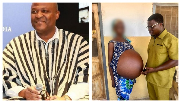 Ibrahim Mahama has settled medical bills of a 14-year-old suffering from stomach tumor