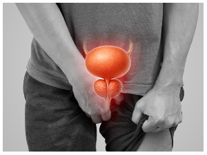 File photo a man suffering from prostrate cancer