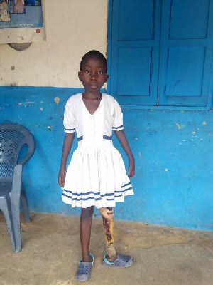 The support is needed to enable a little girl receive medical treatment
