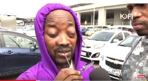 Kofi TV screengrab of a person with eye infection