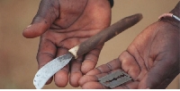 Some of the risks of FGM include severe pain, infections, excessive bleeding and urine retention