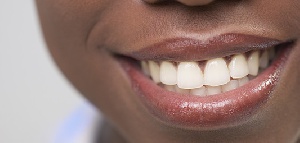 Dental health professionals in the country are inadequate according to Dr. Brown
