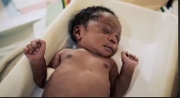 About 1000 newborn die every year