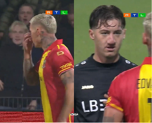 Stiller was mocked for having a large nose