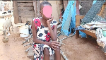 13-year-old girl with a hole-in-the-heart condition abandoned by family