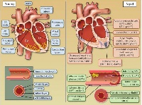 Diagram showing the anatomy of the heart.