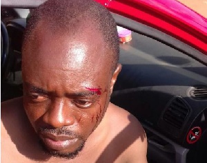 John Teye Victim Matchete Attack