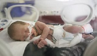 World Prematurity Day is observed on November 17 each year