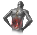 A backache is considered chronic if it lasts more than three months.