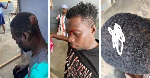 Severe cutlass wounds as Fulani herdsmen, local youth clash over unpaid GH₵ 5 Akpeteshie
