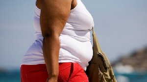 Obesity Overweight Woman