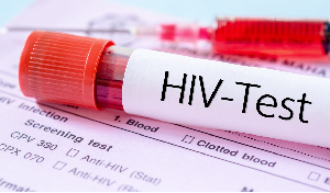 New HIV infections have increased in Bono Region