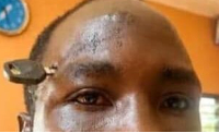 Moro Razak is a 29-year-old farmer from Awoma