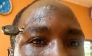 Moro Razak is a 29-year-old farmer from Awoma
