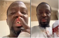 Visual artist  Ibrahim Mahama says he was attacked by IGPs Black Maria