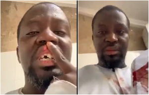Visual artist  Ibrahim Mahama says he was attacked by IGPs Black Maria