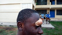 One of the injured students