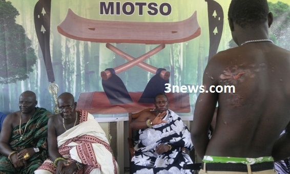 The 15-year-old boy shows his wounds to the press at the Miotso Chief