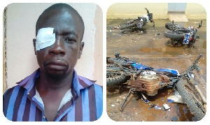 File photo: The man who lost one eye in one of the attacks in September 2016