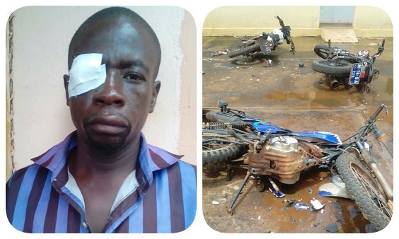 File photo: The man who lost one eye in one of the attacks in September 2016