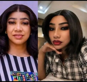 Ola Daniels explains why she underwent facial rejuvenation