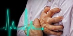 Stroke, heart disease driving nearly 50% of deaths in Ghana – Cardiologist
