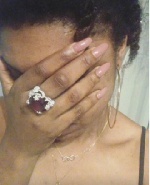 Skin bleaching delays wound healing process - Dr. Brifo