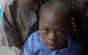 File photo: A child with Down Syndrome