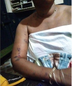 The ex-girlfriend was assaulted by NPP treasuerer