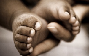 A father is doubtful of claims by doctors and nurses that one of his twin babies is dead