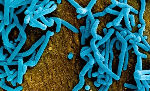 What we know so far about the Ebola outbreak in DRC and Uganda