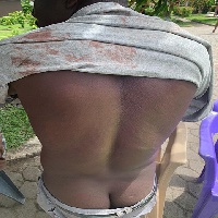 One of the injured people who was lynched by the illegal sand winners