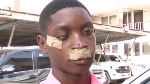 Student assaulted at Swedru during inter-co narrates his ordeal