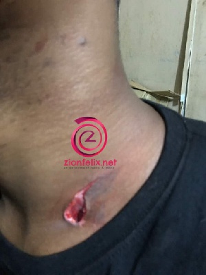 Armstrong Poleeno Addae was stabbed in the neck by unknown person who demanded for his phones