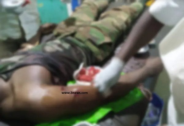 A military officer injured in Bawku in March