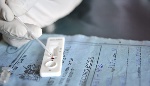 Malaria test
