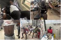 Some of the people injured in the attacks